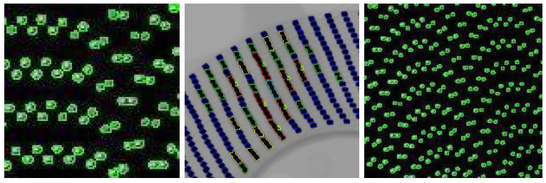 Plate-forme de vérification de la machine de comptage de composants de bobines à rayons X et algorithme d'IA