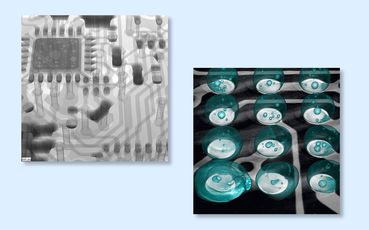 4. Radiographie CT 2D ou 3D De laquelle avez-vous vraiment besoin&nbsp;?