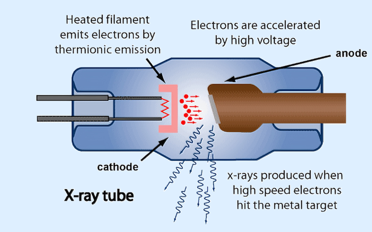 2. Ce que fait r&eacute;ellement la technologie des rayons X
